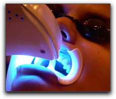 Tooth Whitening Dentistry In Arlington